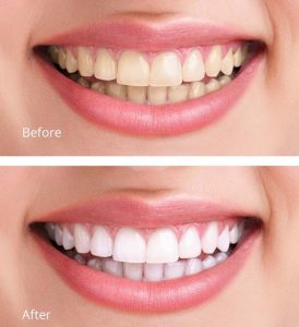 Anne Street Dental