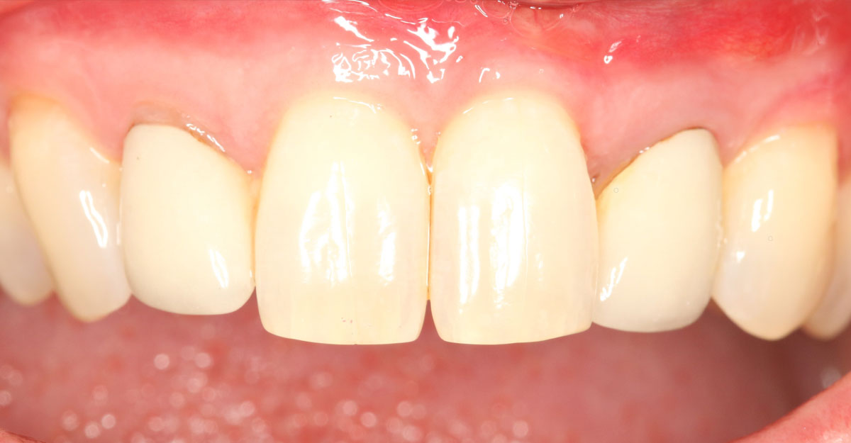Lime Periodontics