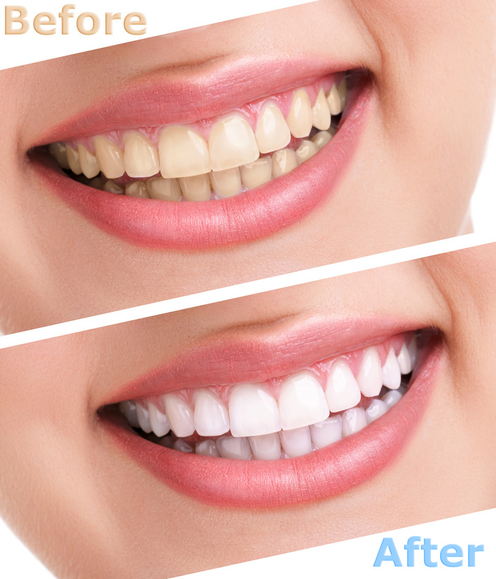 Image of Newmarket Dental Health clinic - Dental Clinic Directory