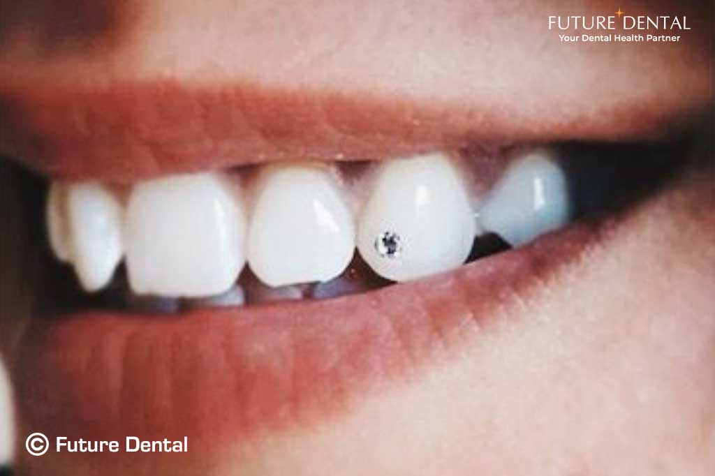 Image of One Dental clinic - Dental Clinic Directory