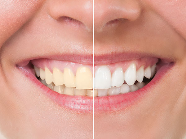 Image of Dr. Vijay Badhwar clinic - Dental Clinic Directory