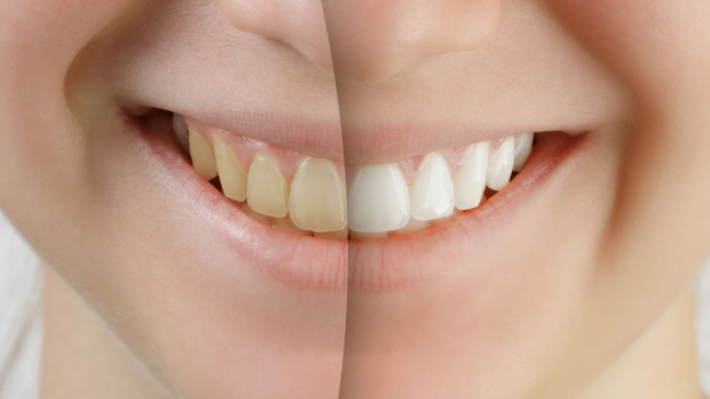 Image of Bathurst Dundas Dental Centre | Dr. Howard Lim clinic - Dental Clinic Directory
