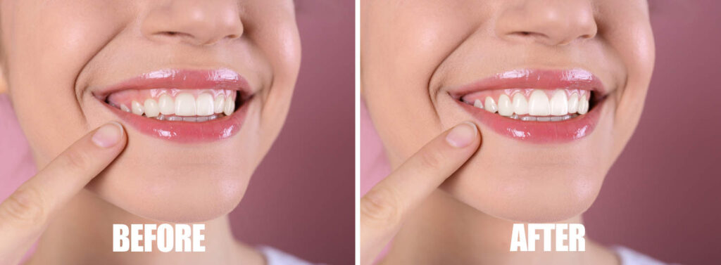 Image of Bloor Smile Dental clinic - Dental Clinic Directory