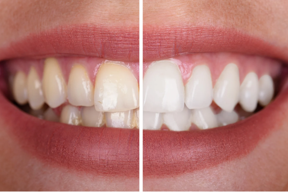 Image of Bloor West Dental, Health & Wellness clinic - Dental Clinic Directory