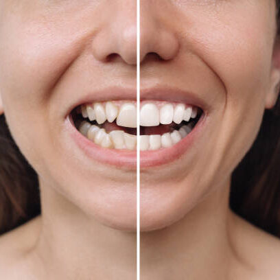 Image of Bloor West Dental, Health & Wellness clinic - Dental Clinic Directory