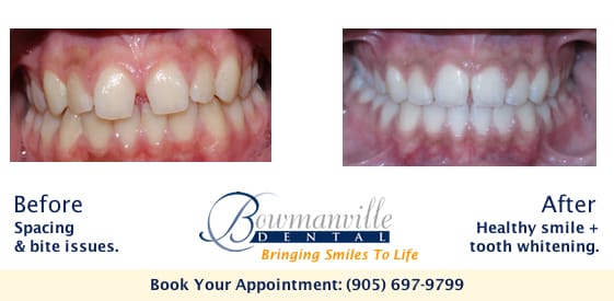 Image of Bowmanville Dental clinic - Dental Clinic Directory