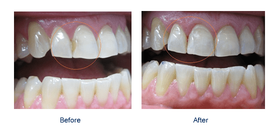 Image of Bowmanville Dental clinic - Dental Clinic Directory