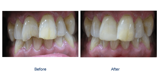 Image of Bowmanville Dental clinic - Dental Clinic Directory