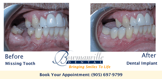 Image of Bowmanville Dental clinic - Dental Clinic Directory