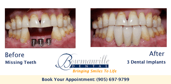 Image of Bowmanville Dental clinic - Dental Clinic Directory