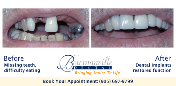 Image of Bowmanville Dental clinic - Dental Clinic Directory