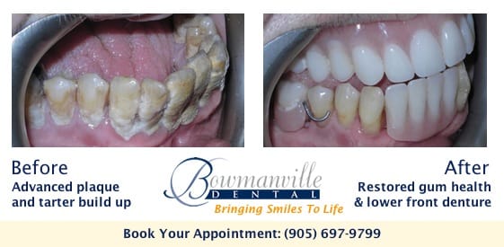 Image of Bowmanville Dental clinic - Dental Clinic Directory