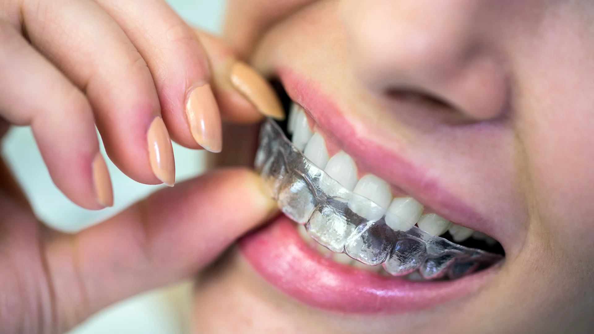 Image of Bridge West Dental Office clinic - Dental Clinic Directory