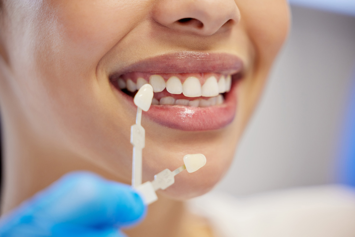Brinkley Dental Group