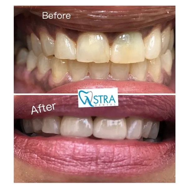 Astra Dental