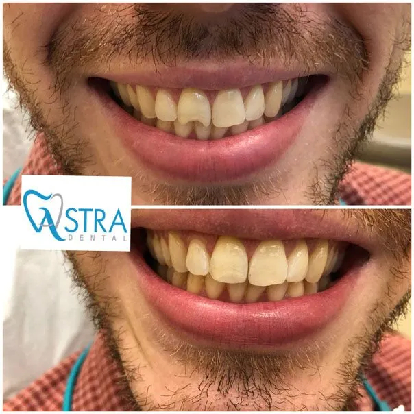 Image of Astra Dental clinic - Dental Clinic Directory