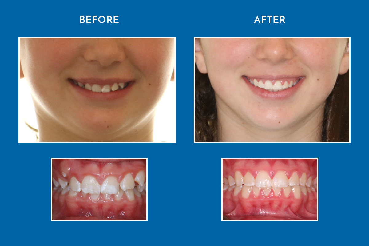 Image of Orthodontics on Queen clinic - Dental Clinic Directory