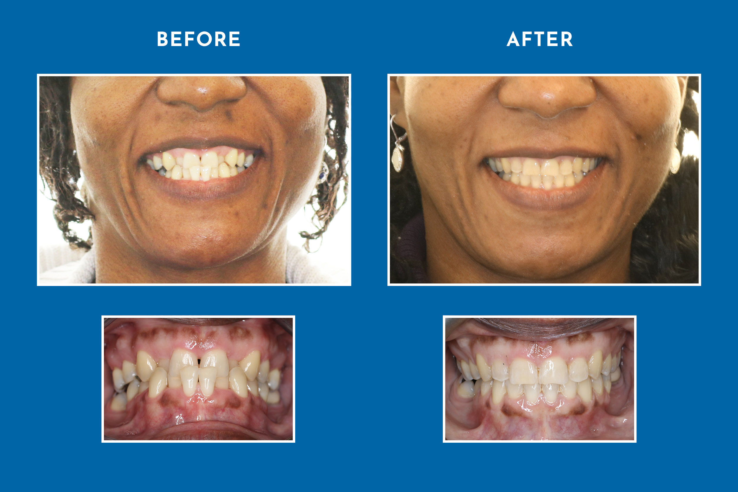 Orthodontics on Queen