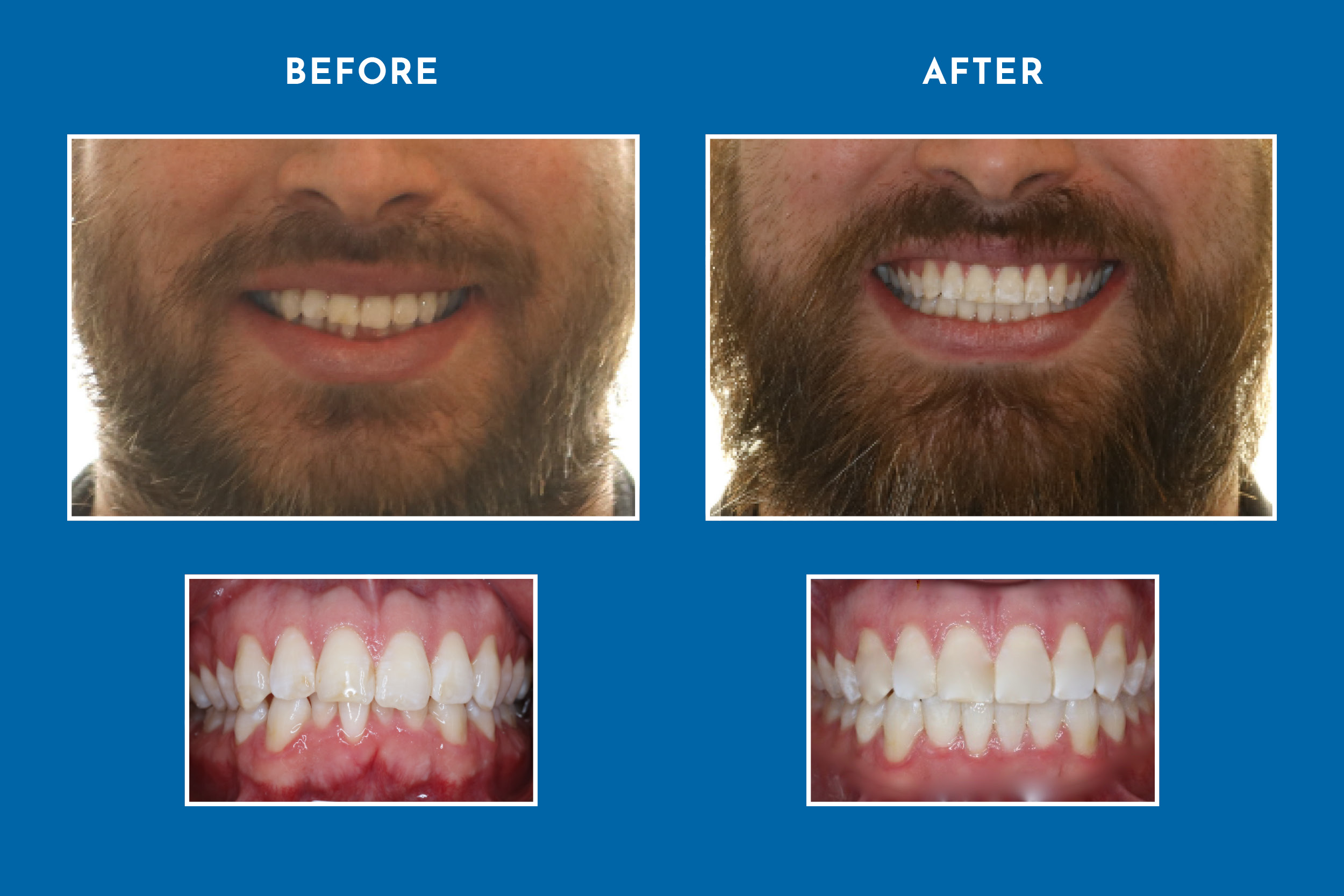 Image of Orthodontics on Queen clinic - Dental Clinic Directory