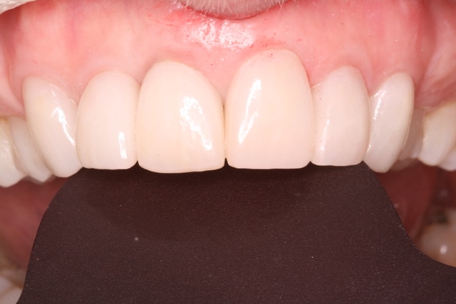 Dentistry @ Bank Street Professional Centre