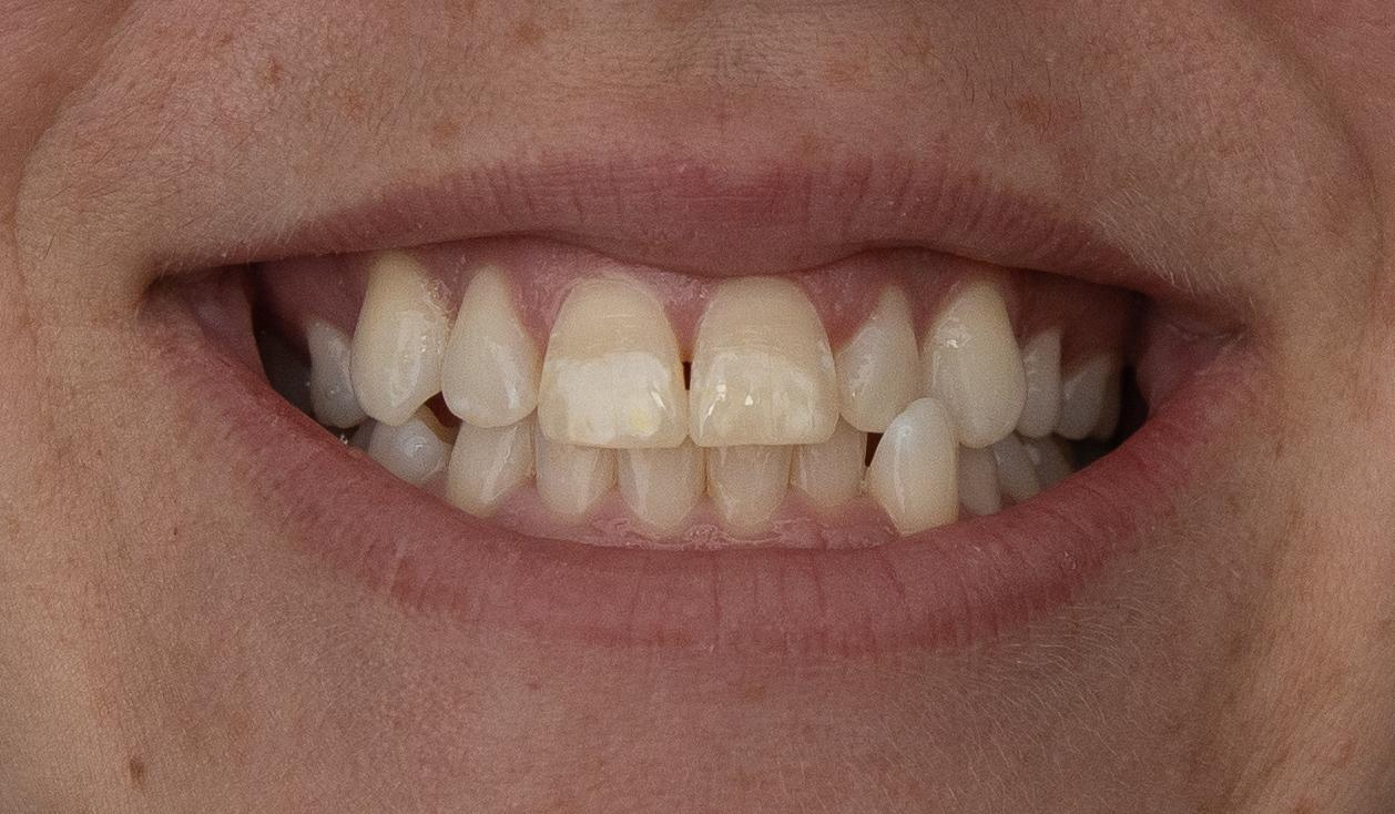 Clarence Street Dental