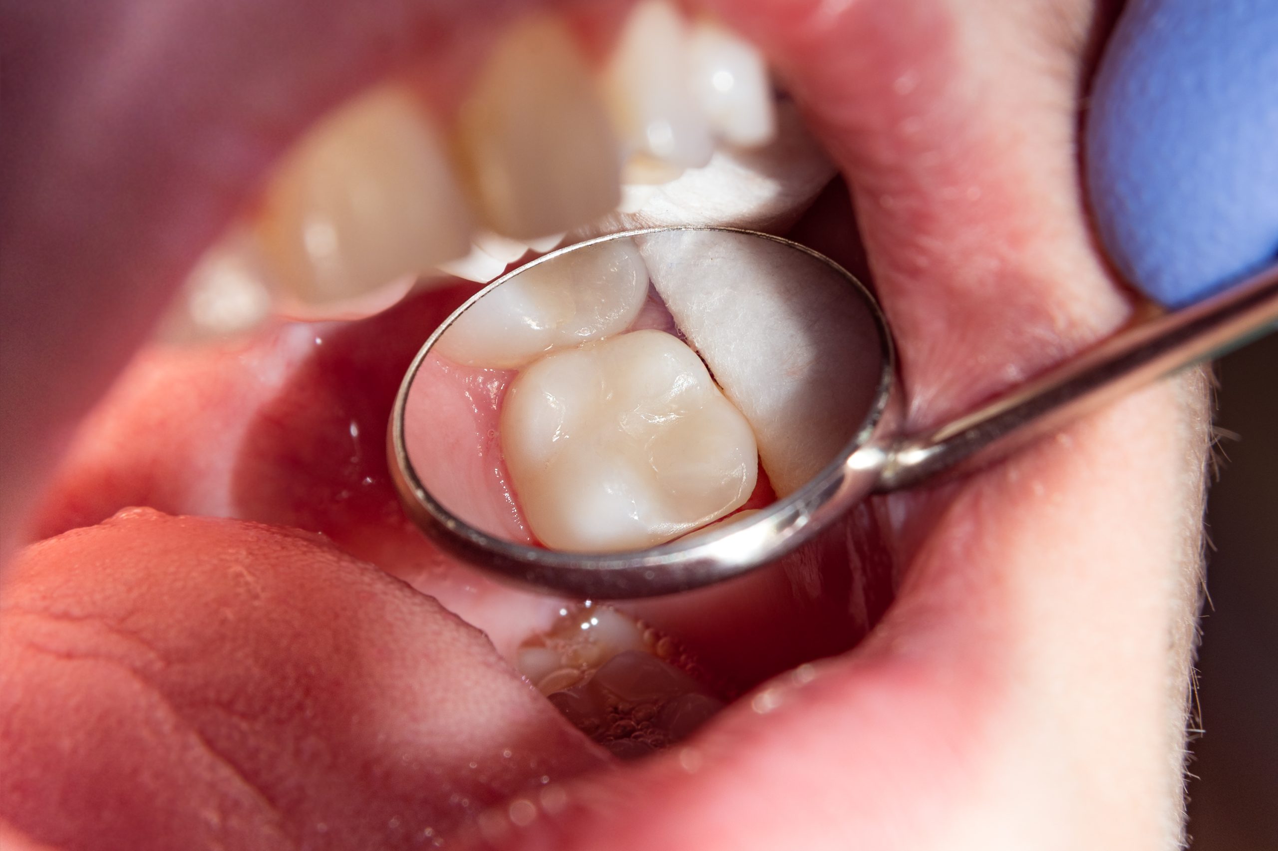 Image of Clearview Dental Clinic Milton clinic - Dental Clinic Directory