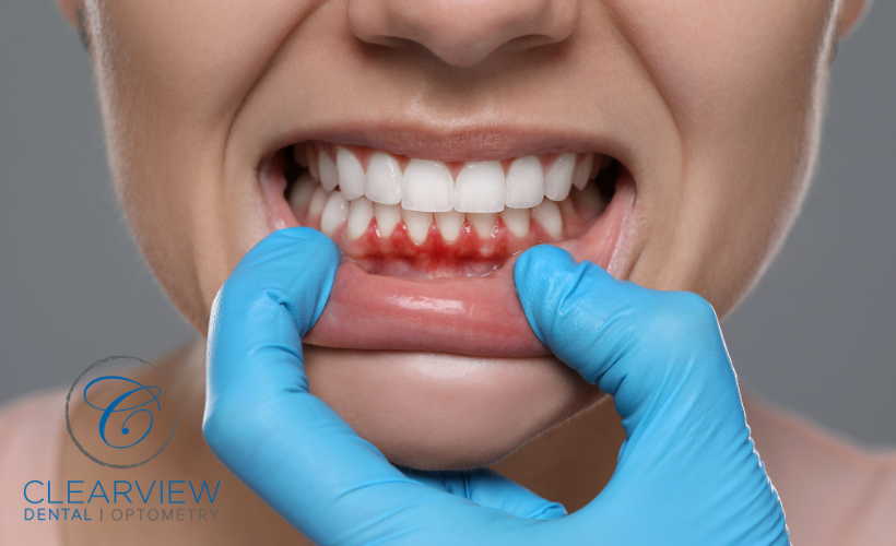 Image of Clearview Dental Clinic Milton clinic - Dental Clinic Directory