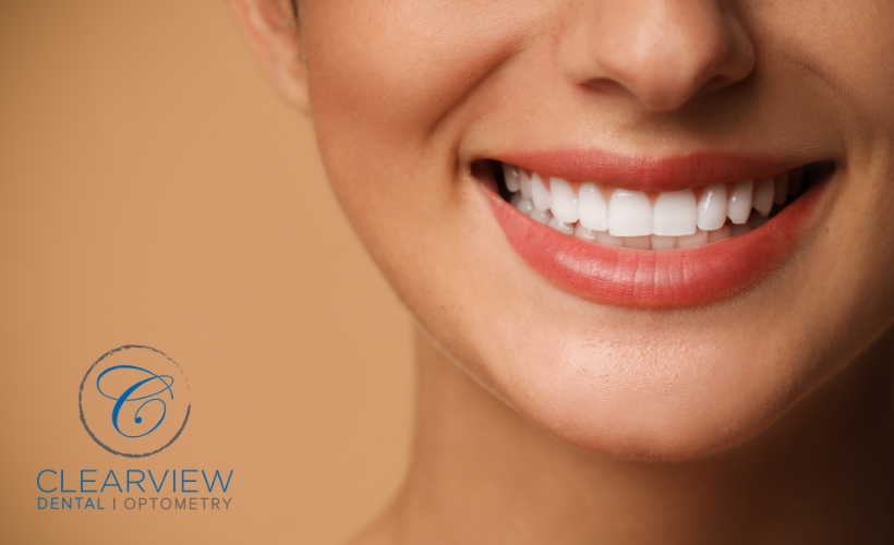 Image of Clearview Dental Clinic Milton clinic - Dental Clinic Directory