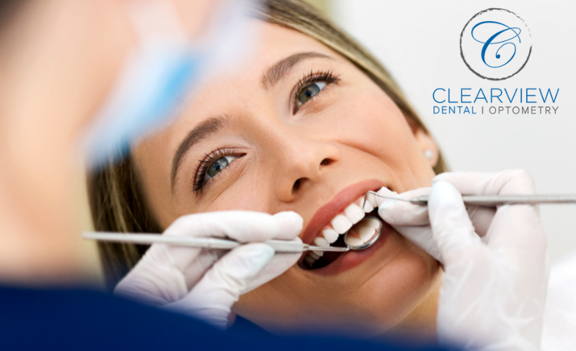 Image of Clearview Dental Clinic Milton clinic - Dental Clinic Directory