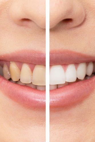 Image of Clearview Dental Clinic Milton clinic - Dental Clinic Directory