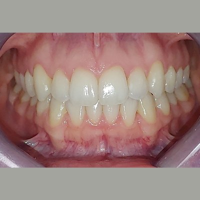 Ottawa Downtown Dentist