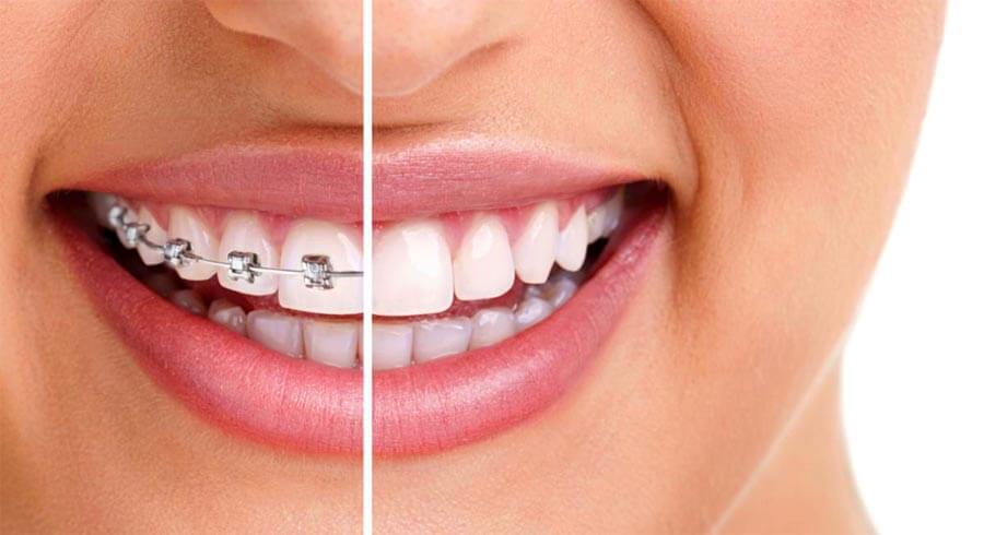 Image of Dental Solutions - Dr. J. Gangwani & Dr. Mike Narayansingh (Orthodontics, Cosmetic, General, Emergency) clinic - Dental Clinic Directory