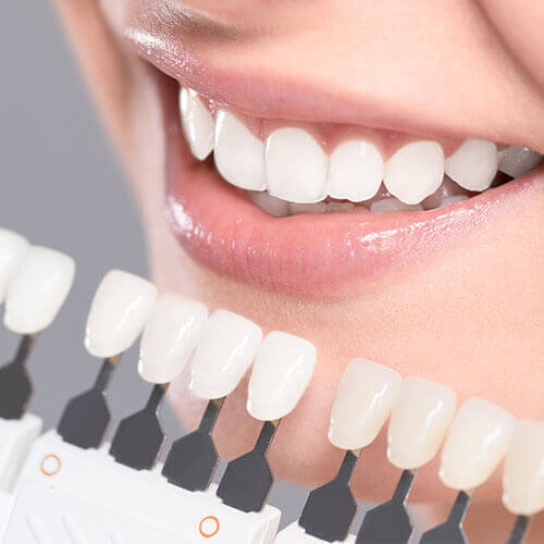 Image of Dental Solutions - Dr. J. Gangwani & Dr. Mike Narayansingh (Orthodontics, Cosmetic, General, Emergency) clinic - Dental Clinic Directory