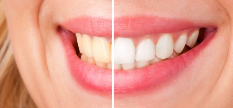 Image of Two Lakes Dental clinic - Dental Clinic Directory