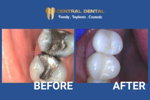 Image of Central Dental clinic - Dental Clinic Directory