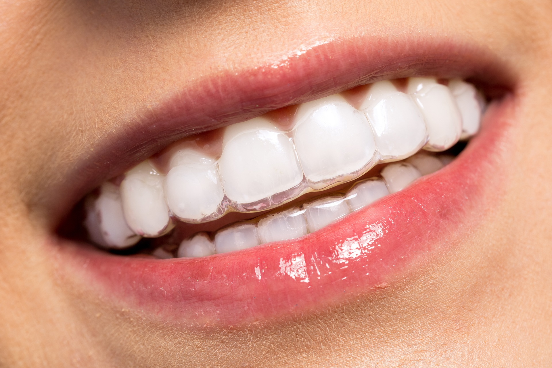 Image of Dentys Tooth Care clinic - Dental Clinic Directory