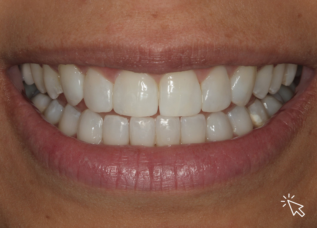 Wellington Aurora Dental