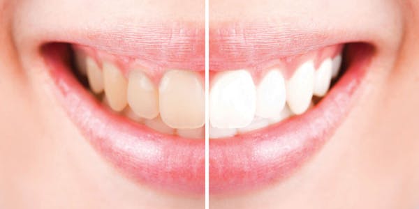 Image of Earlsbridge Dental clinic - Dental Clinic Directory