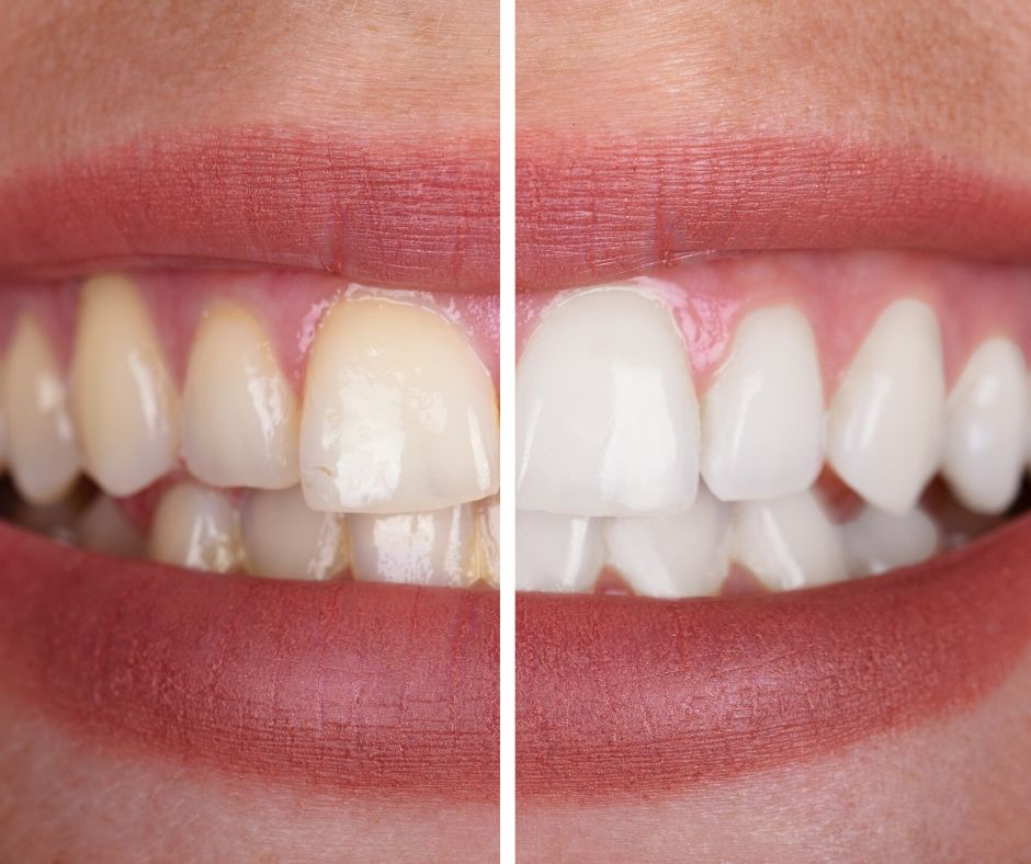 Image of Escarpment View Dental clinic - Dental Clinic Directory