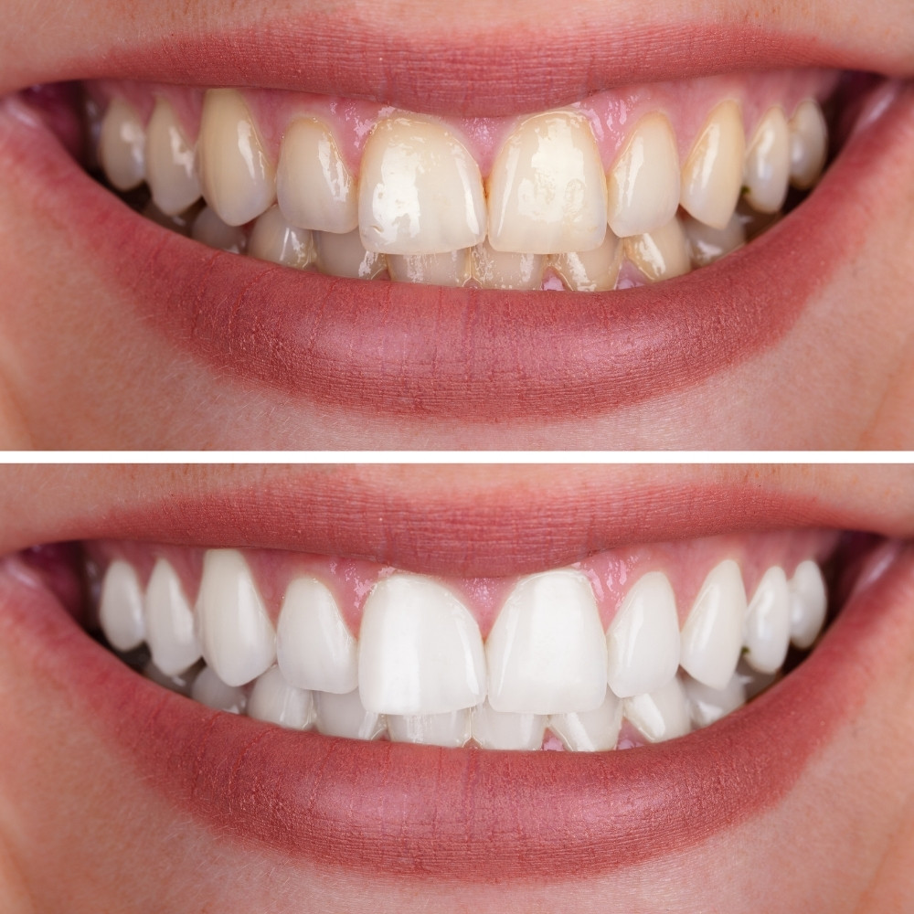 Image of PL Dental By Everbright Smiles clinic - Dental Clinic Directory