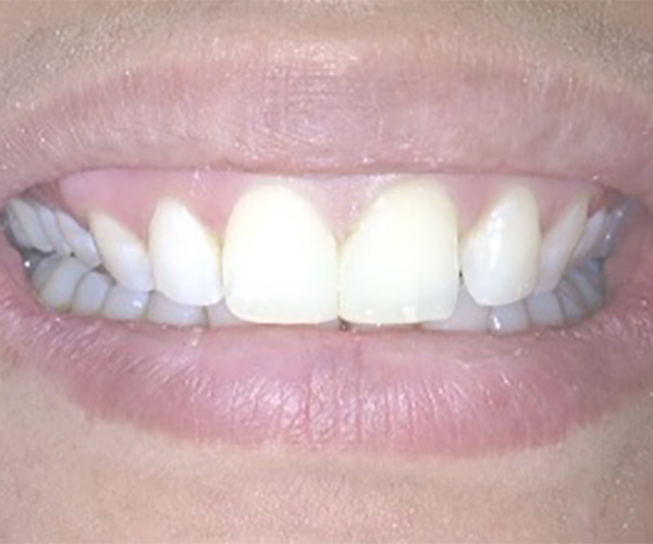 Image of Ellesmere Victoria Park (EVP) Dental Dr. Malaekeh Zarrabian clinic - Dental Clinic Directory