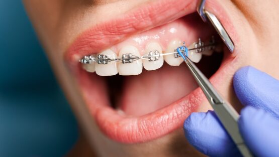 Image of Forest Hill Village Orthodontics - Dr. David Hirsch clinic - Dental Clinic Directory