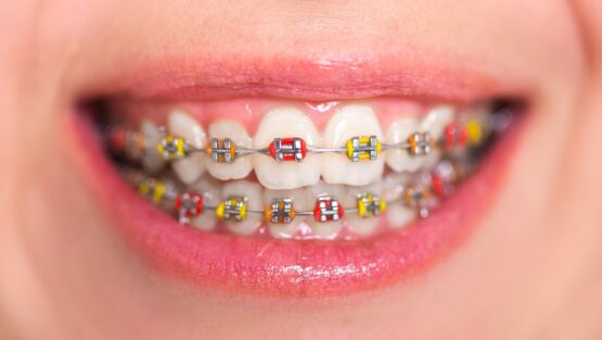 Forest Hill Village Orthodontics - Dr. David Hirsch