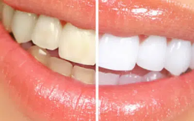 Image of Dentistry at The Grove clinic - Dental Clinic Directory