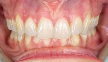 Image of Heritage Dental (formerly Smilez Dentistry) clinic - Dental Clinic Directory