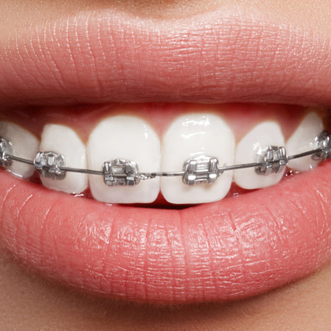 Image of Hola Dentistry ,Bradford Holland street family dentist clinic - Dental Clinic Directory