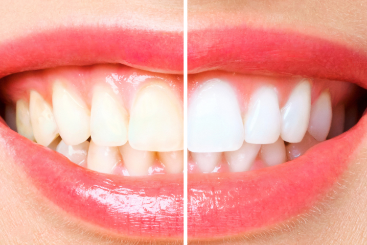 Image of Hola Dentistry ,Bradford Holland street family dentist clinic - Dental Clinic Directory