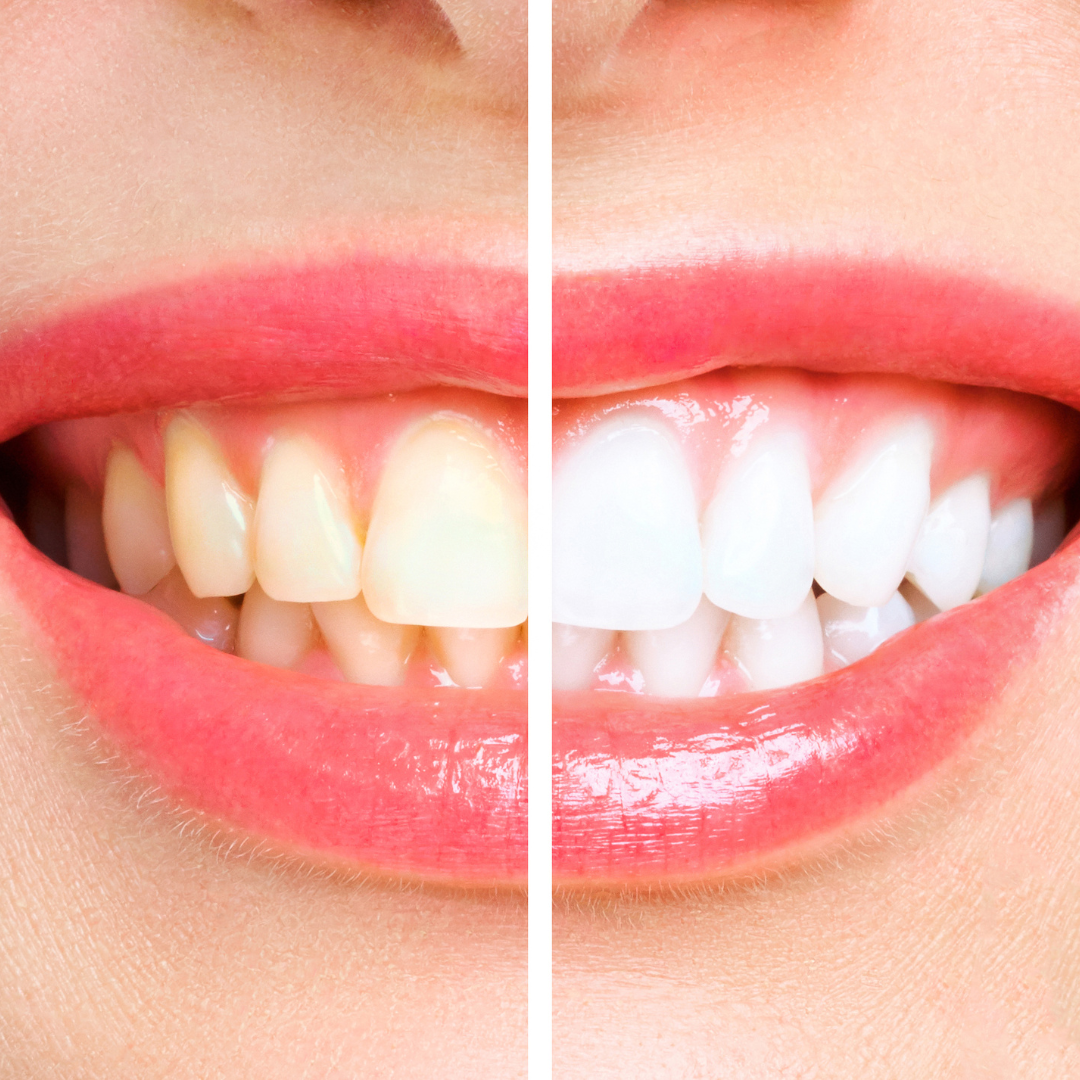 Image of Hola Dentistry ,Bradford Holland street family dentist clinic - Dental Clinic Directory