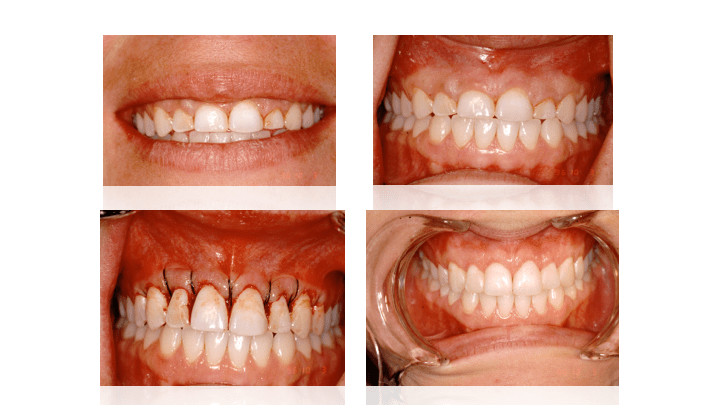 Bruce Grey Dental Centre