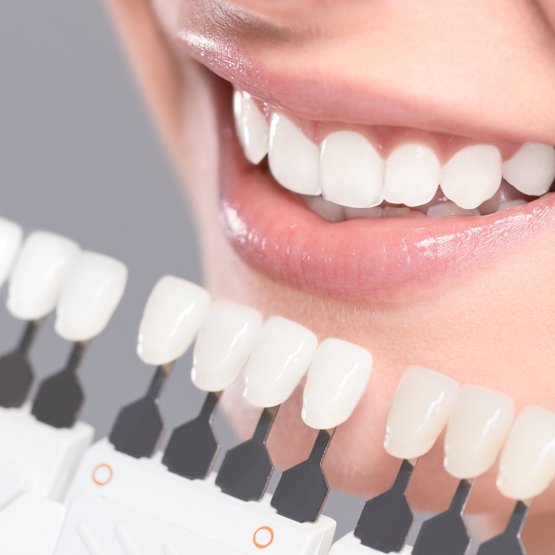 Image of Lily Lake Dental clinic - Dental Clinic Directory